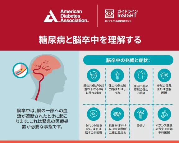 ADA infographic: Understanding Diabetes and Stroke. Features brain, heart diagrams.